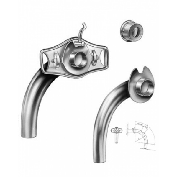 Tracheotomy